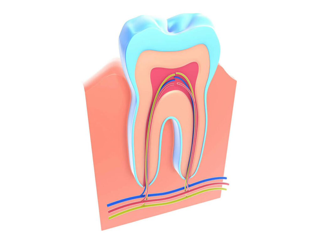 Model of a root canal