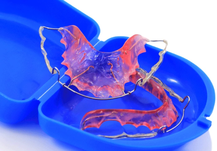 Retainers at Willow Dental in Berlin, WI.