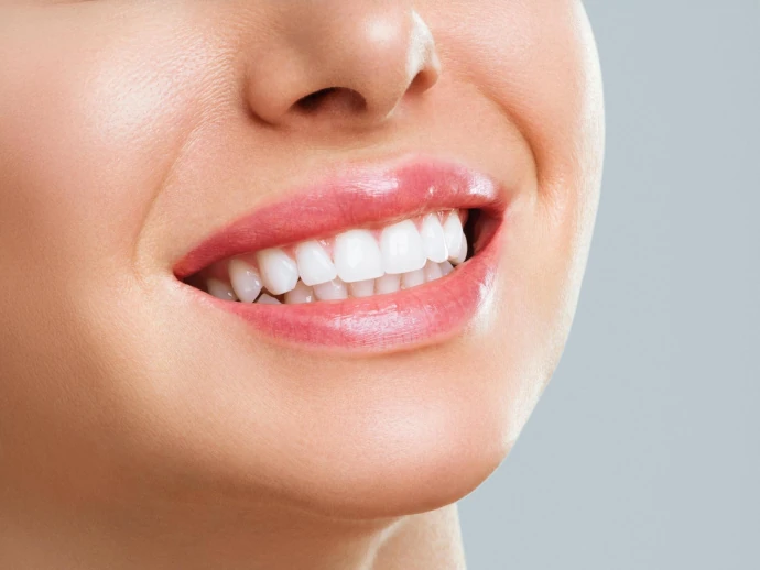 Smile makeover dental service at Willow Dental in Berlin, WI.