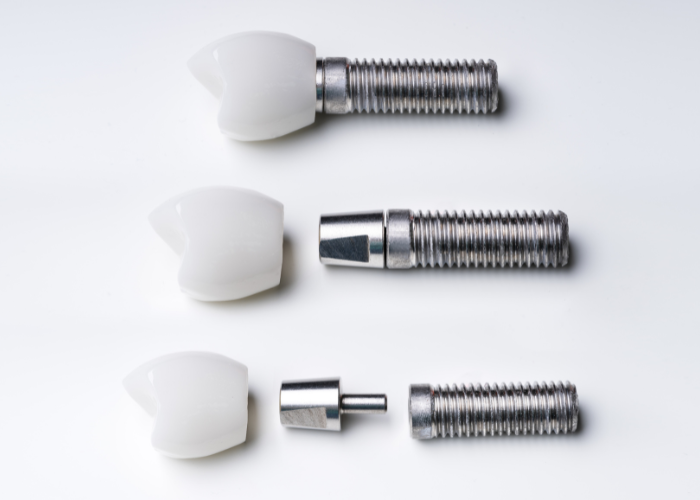 Close-up image of dental implants.
