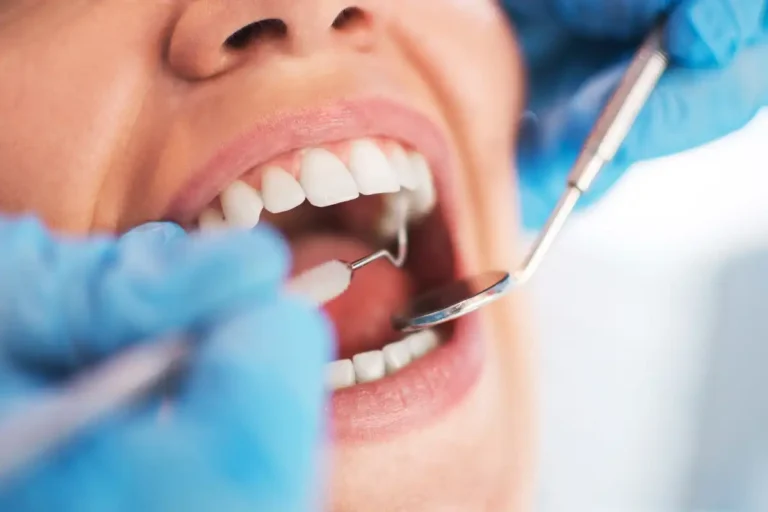 Why Are Routine Dental Checkups Important?